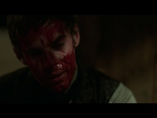 Череп и кости